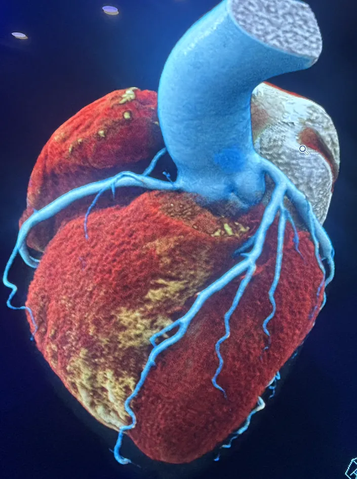 Dr. Edgar Tavares – Ultrasonido e Imagen cardiovascular