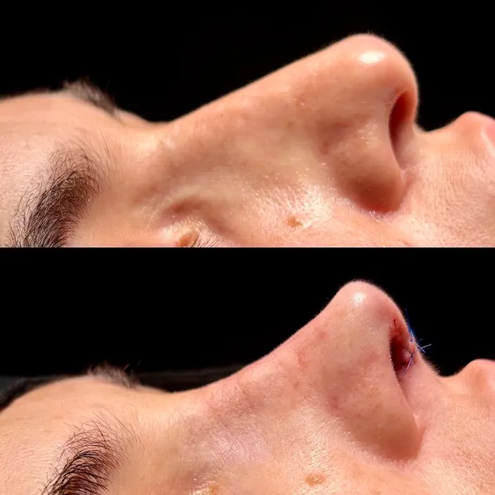 Dr. Ronaldo Tamez, Otorrinolaringología, Cirugía Plástica Facial, Clínica del Ronquido y Apnea Obstructiva del Sueño.